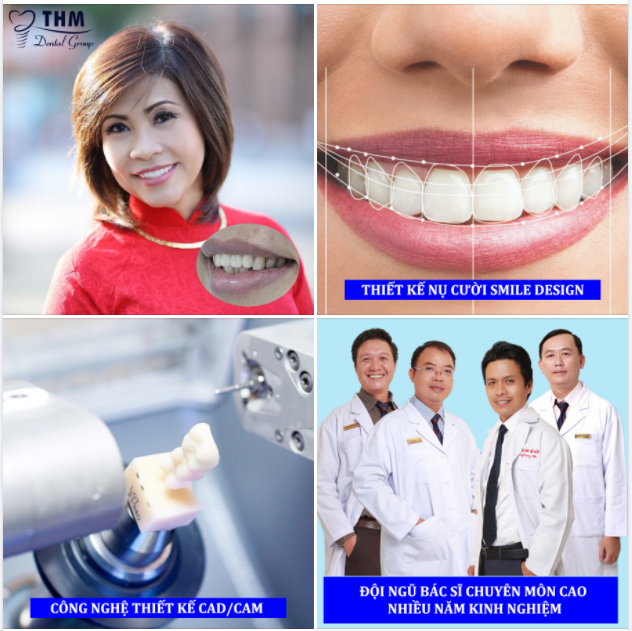 RĂNG TRẮNG CƯỜI XINH - RƯỚC NGÀN TÀI LỘC