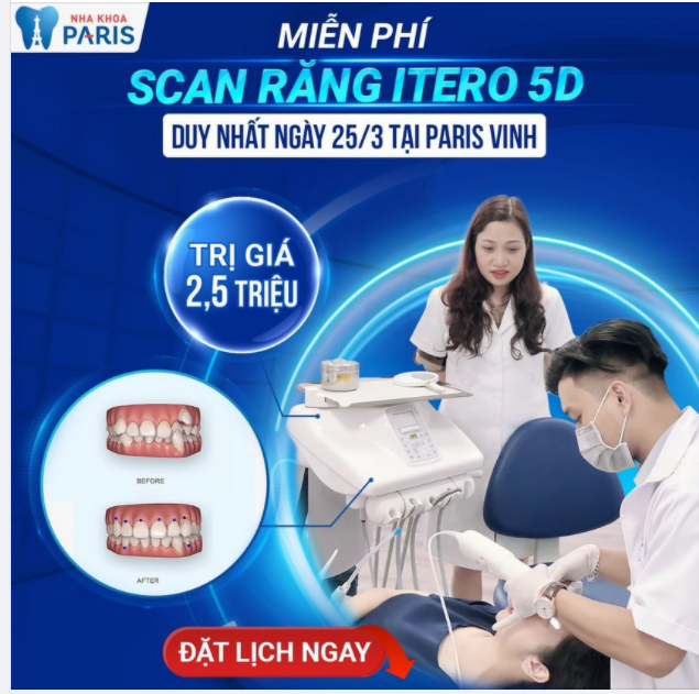 Scan răng iTero 5D MIỄN PHÍ tại Nghệ An