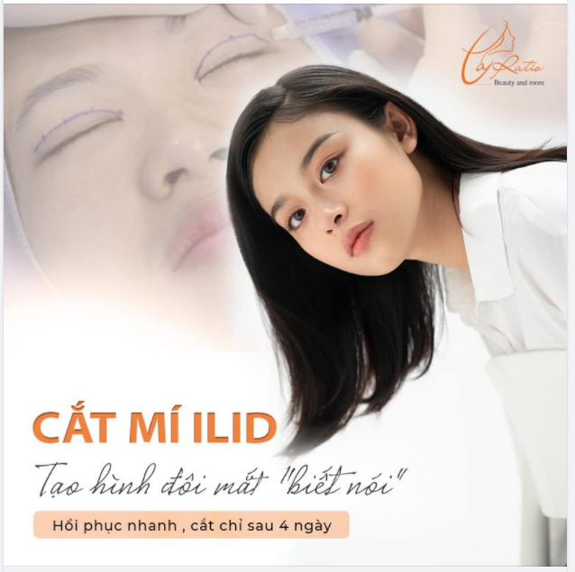 SỞ HỮU ĐÔI MẮT BIẾT NÓI CÙNG LA RATIO