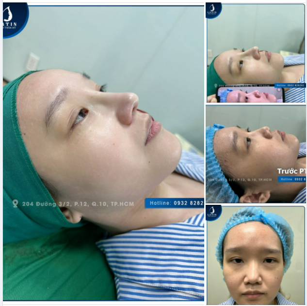 So sánh với hình ảnh của 1 tiếng trước sẽ ngạc nhiên thật sự.
