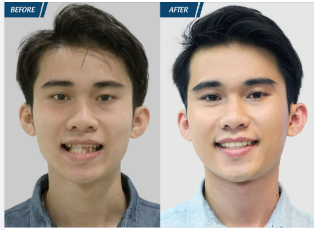SỰ THAY ĐỔI NGOẠN MỤC CỦA CHÀNG HOTBOY VỚI VỚI NỤ CƯỜI TẮT NẮNG