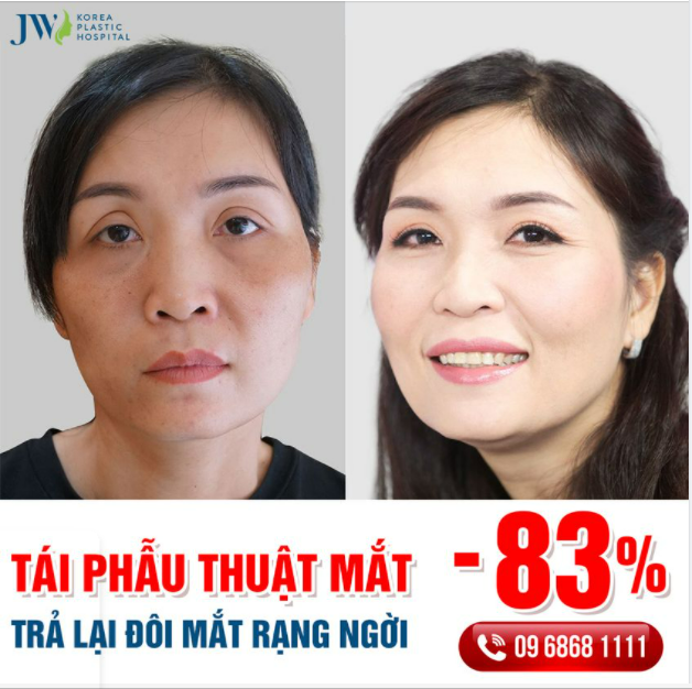 TÁI PHẪU THUẬT MẮT – CỨU LẤY NHỮNG ĐÔI MẮT HƯ