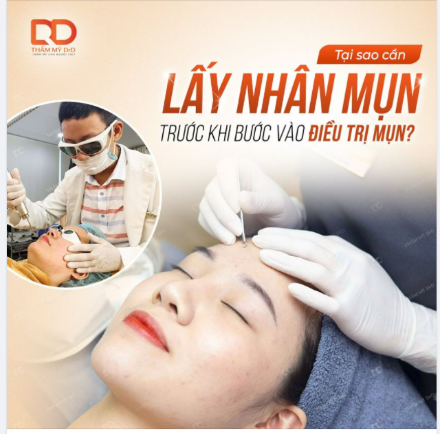 Tại sao cần lấy nhân mụn trước khi bước vào điều trị mụn