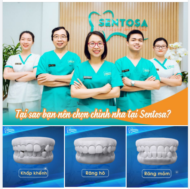 TẠI SAO NÊN CHỌN CHỈNH NHA TẠI SENTOSA