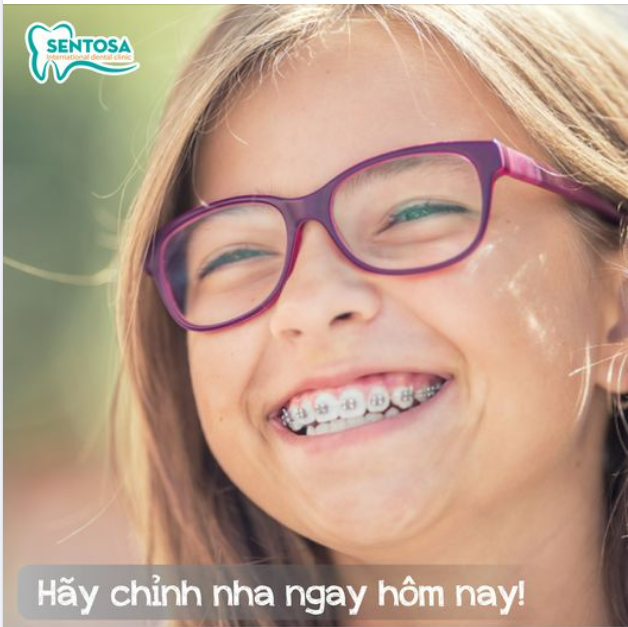 TẠI SAO PHẢI CHỈNH NHA NGAY HÔM NAY