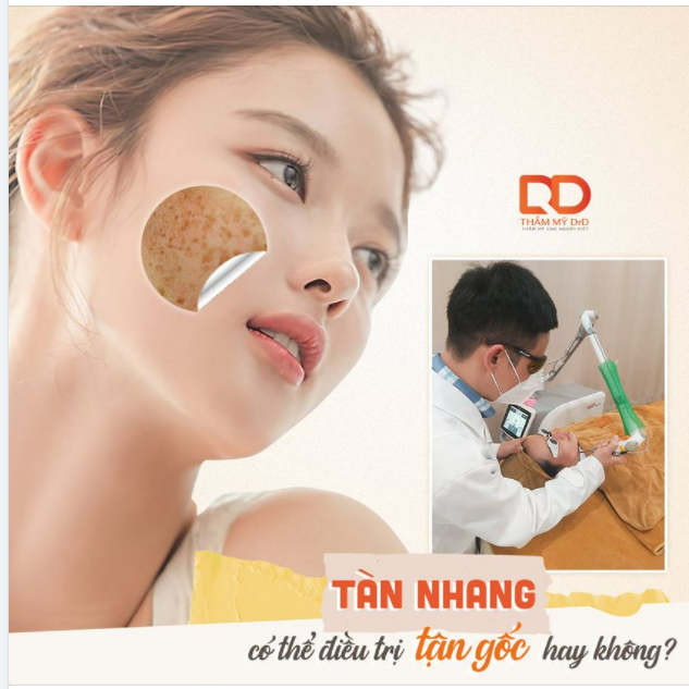 Tàn nhang có thể điều trị tận gốc hay không