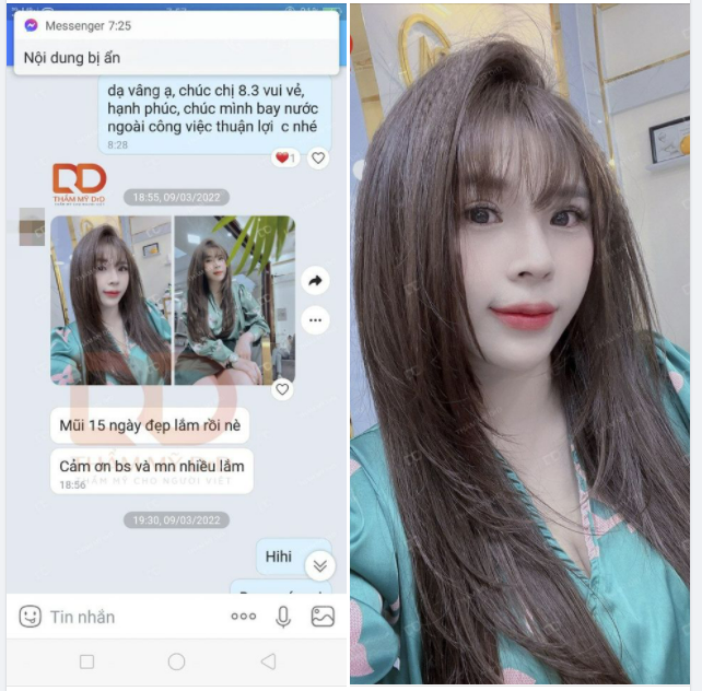 Thả nhẹ chiếc feedback Nâng mũi Perfect Dform lấy động lực cho team DrD và chúc các nàng một tuần mới nhiều niềm vui