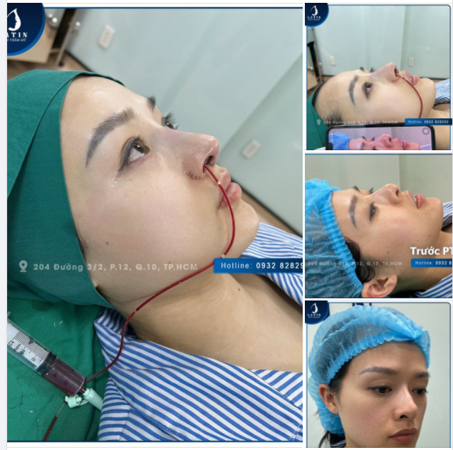 Thả ở đây một chiếc mũi xinh... xem có ai TRẦM TRỒ