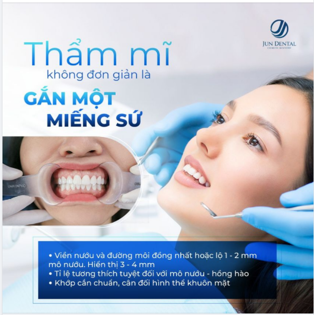 Thẩm mĩ răng xong mô nướu hồng hào, tỉ lệ tương thích tuyệt đối như thế này thì chỉ có tại Jun Dental!