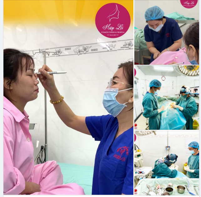 THẨM MỸ NÂNG MŨI CÓ ĐAU NHƯ BẠN NGHĨ