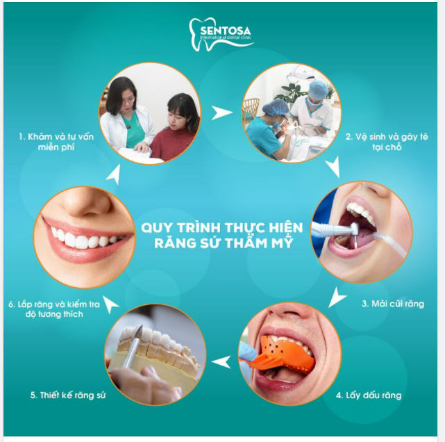 THẨM MỸ RĂNG SỨ- GIẢI PHÁP TÌM LẠI NỤ CƯỜI TỰ TIN