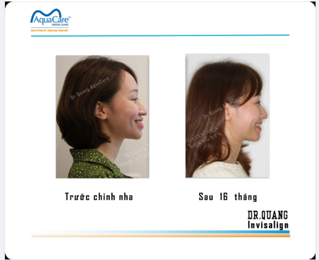 Tháng ba bất chợt một ngày Trắng tinh hoa sưa về đây