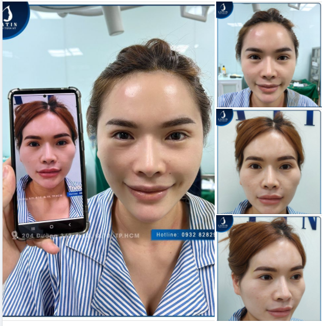THAY ĐỔI một chút nhưng XINH ĐẸP nhiều chút