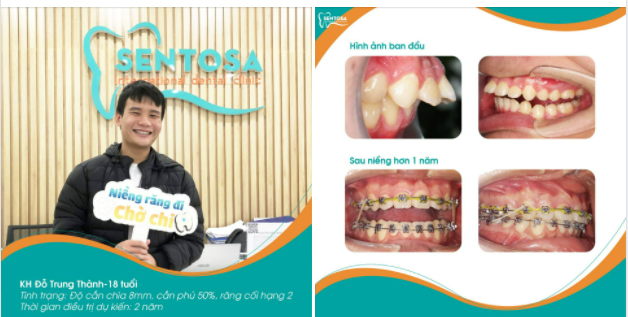 THAY ĐỔI NỤ CƯỜI - THAY ĐỔI CUỘC SỐNG