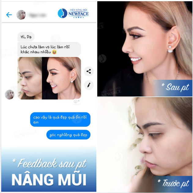 THAY GÓC NGHIÊNG ĐỔI DIỆN MẠO QUÁ XUẤT SẮC CẢ NHÀ ƠI!