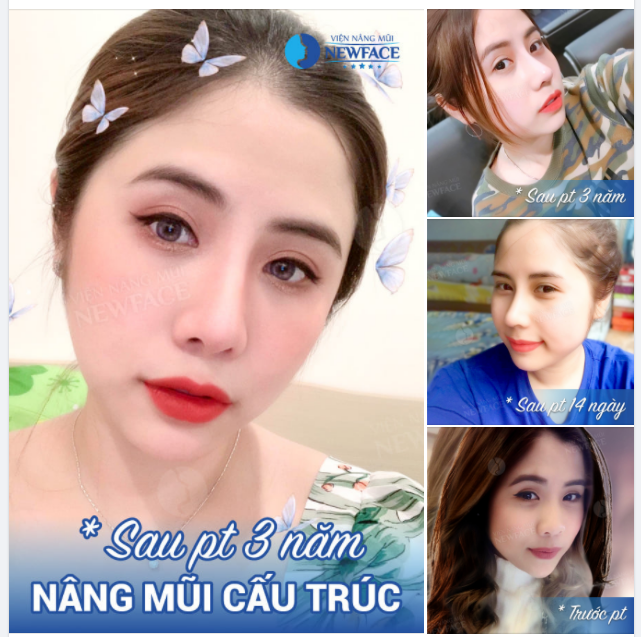 Thế gian cỏ lạ nhiều vô kể, Cớ sao nhớ mãi một nhành hoa.