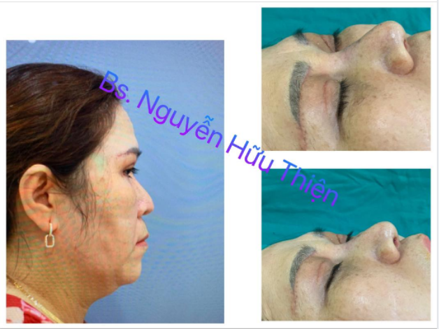 Thiện mỹ tiếp nhận môt chị khách từ phương xa