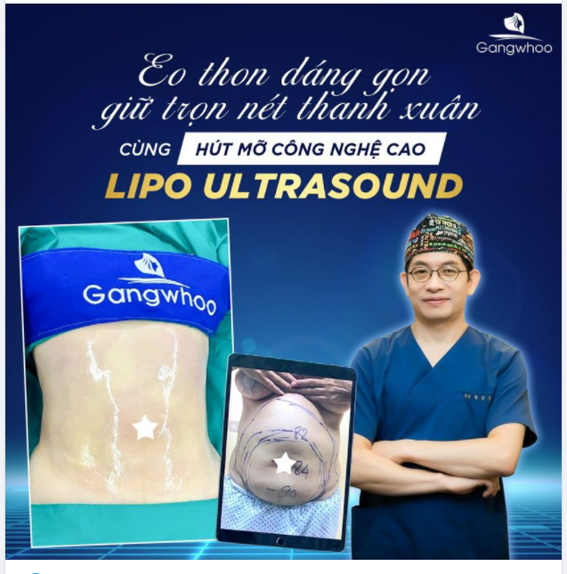 THON TRẺ KHỎE ĐẸP HƠN CÙNG HÚT MỠ (CÔNG NGHỆ CAO LIPO ULTRASOUND)