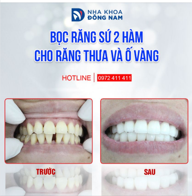 TỈ MỈ TRONG TỪNG THAO TÁC ĐẾN KHI KHÁCH HÀNG THỰC SỰ HÀI LÒNG