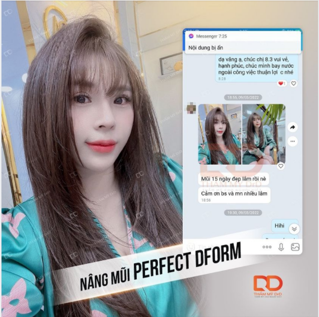 Top những dáng mũi được yêu thích nhất