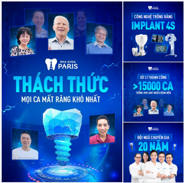 Trồng răng implant - chọn Nha khoa Paris Công nghệ - Kinh nghiệm - Uy tín