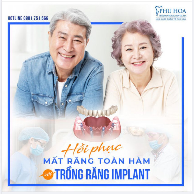 TRỒNG RĂNG IMPLANT – GIẢI PHÁP SỐ 1 CHO NGƯỜI MẤT RĂNG TOÀN HÀM