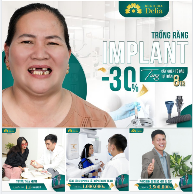 TRỒNG RĂNG IMPLANT Giảm 30%