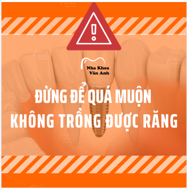 TRỒNG RĂNG TRƯỚC KHI “KHÔNG THỂ” TRỒNG ĐƯỢC
