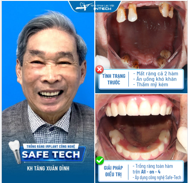 TỪ NAY CHÚ ĐÃ CÓ THỂ ĂN UỐNG THOẢI MÁI...