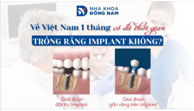 TƯ VẤN TRỒNG RĂNG IMPLANT CHO VIỆT KIỀU VỀ NƯỚC CÓ ÍT THỜI GIAN