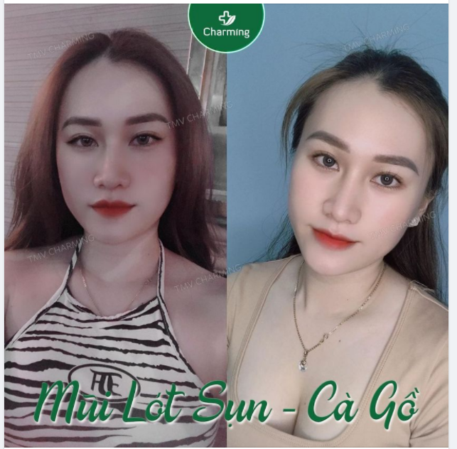 Tuy hôm nay là ngày 08 tháng 03, nhưng có lẽ là không đoá hoa nào đẹp như nàng khách đây rồi