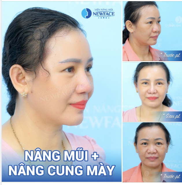 ƯỚC MƠ THAY ĐỔI GẦN 10 NĂM ĐÃ THÀNH SỰ THẬT