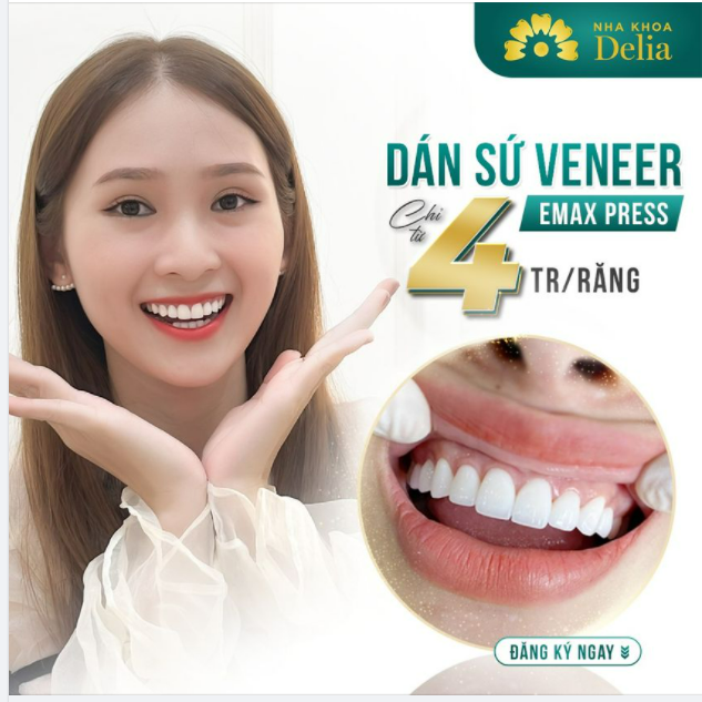 ƯU ĐÃI Dán sứ veneer Giải pháp hoàn hảo cho các trường hợp