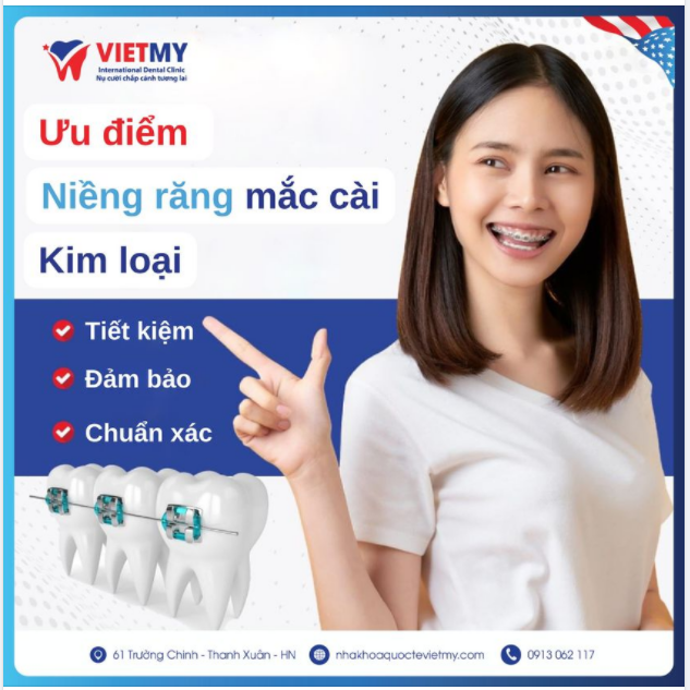 ƯU ĐIỂM CỦA NIỀNG RĂNG MẮC CÀI KIM LOẠI