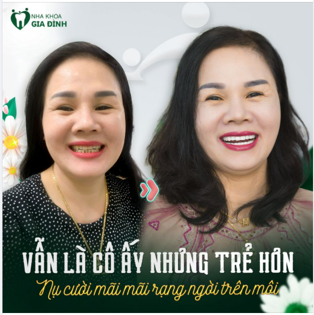 VẪN LÀ CÔ ẤY NHƯNG LẠI Ở PHIÊN BẢN TRẺ HƠN