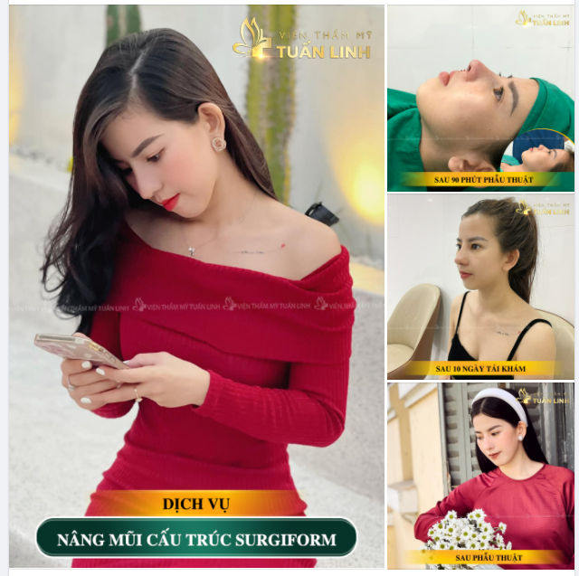 VÌ SAO KHÁCH HÀNG TIN TƯỞNG LỰA CHỌN NÂNG MŨI TẠI TUẤN LINH