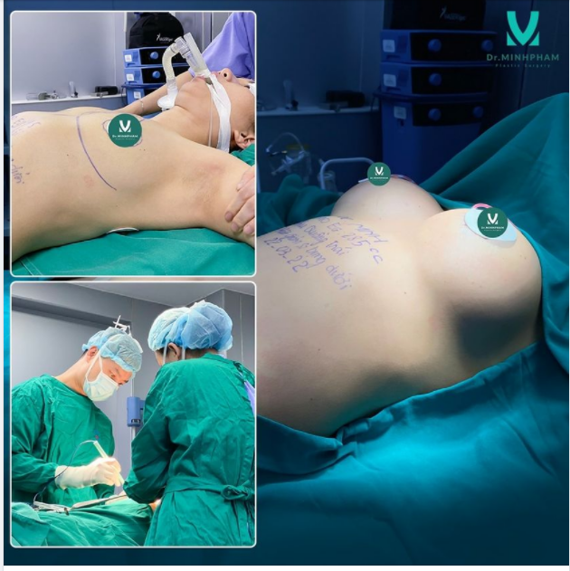 Vòng 1 phẳng, teo nhỏ sau sinh, không đều