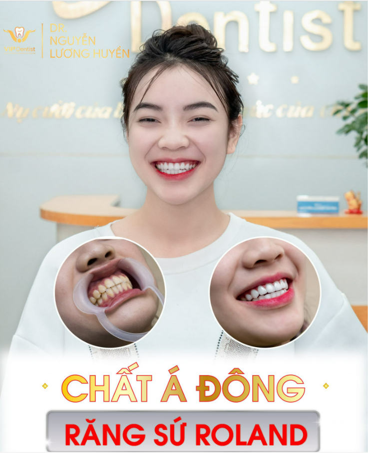 VƯỢT CHUẨN 3 TIÊU CHÍ VÀNG, NỮ KHÁCH HÀNG TỰ TIN KHOE NỤ CƯỜI ĐẬM CHẤT Á ĐÔNG
