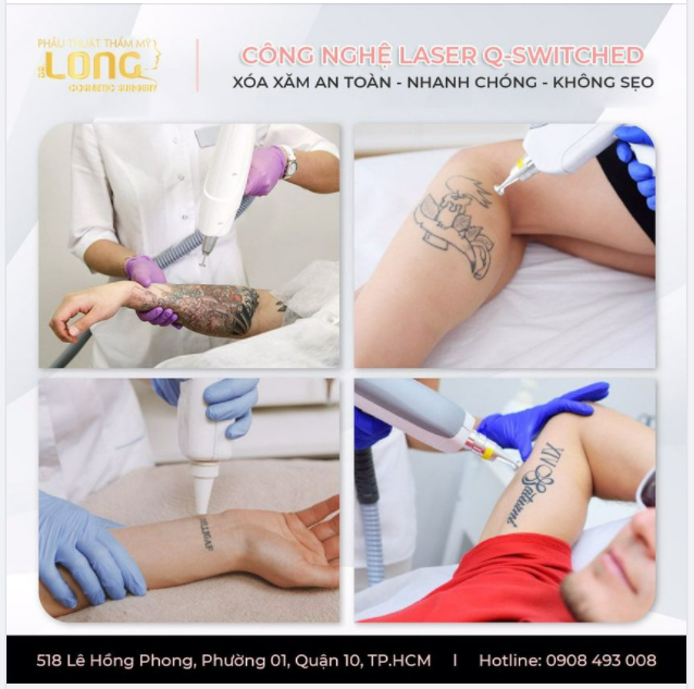 XOÁ XĂM THẦN TỐC - ƯU ĐÃI SIÊU SỐC