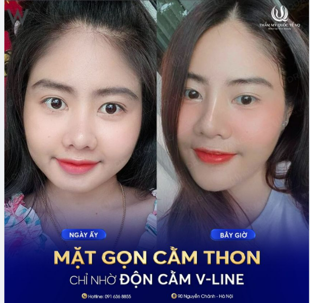 1 chờ - 2 đợi - 3 trông Thay đổi thế này ưng không cả nhà