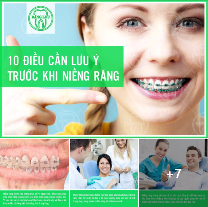 10 ĐIỀU CẦN LƯU Ý TRƯỚC KHI NIỀNG RĂNG