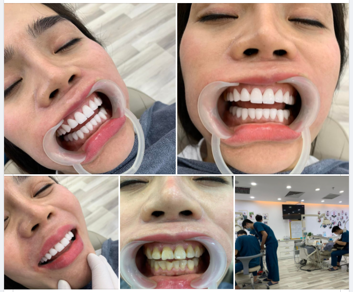 100% các khách hàng đến Delia đều hài lòng tuyệt đối.