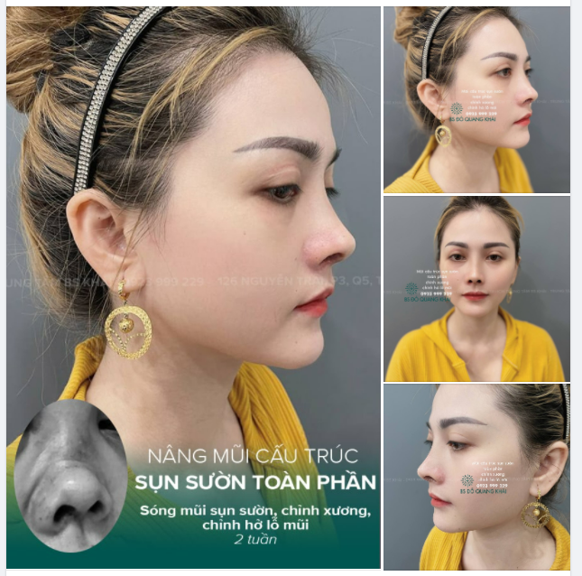 14 NGÀY LỘT XÁC TỪ TAI NẠN KINH HOÀNG