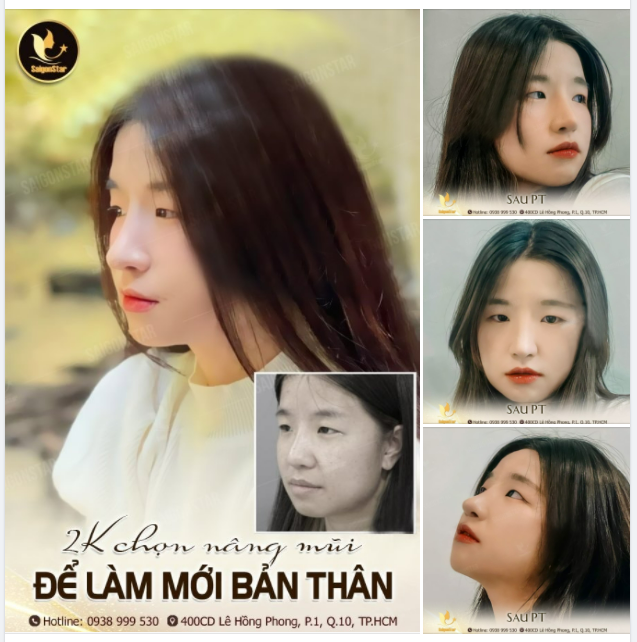 2K CHỌN NÂNG MŨI ĐỂ LÀM MỚI BẢN THÂN