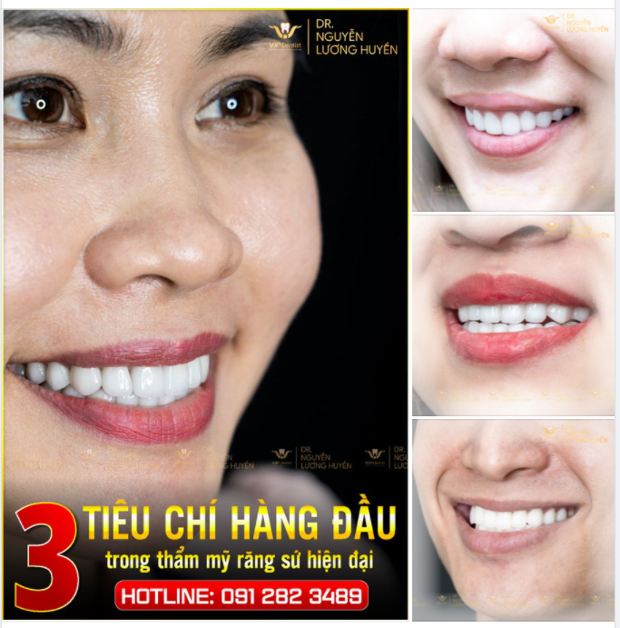 3 TIÊU CHÍ HÀNG ĐẦU TRONG THẨM MỸ RĂNG SỨ HIỆN ĐẠI