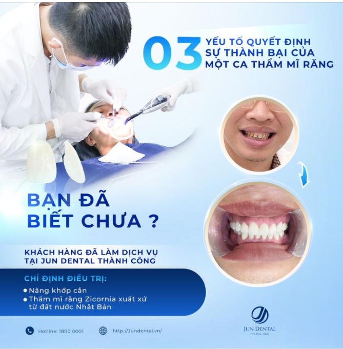 3 YẾU TỐ QUYẾT ĐỊNH KHÔNG THỂ BỎ QUA TRƯỚC KHI TIẾN CA THÀNH MỘT CA THẨM MĨ RĂNG SỨ