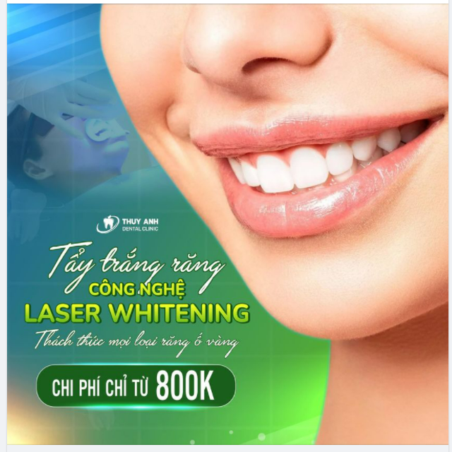 30' Đổi Lấy Nụ Cười Trắng Sáng