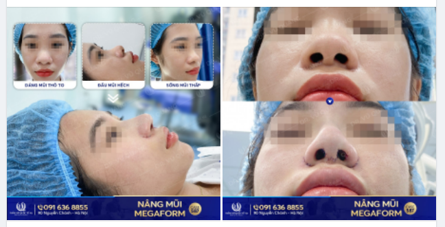 45 phút Rinh ngay mũi xinh về nhà