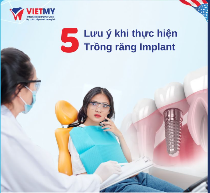 5 LƯU Ý TRƯỚC KHI TRỒNG RĂNG IMPLANT