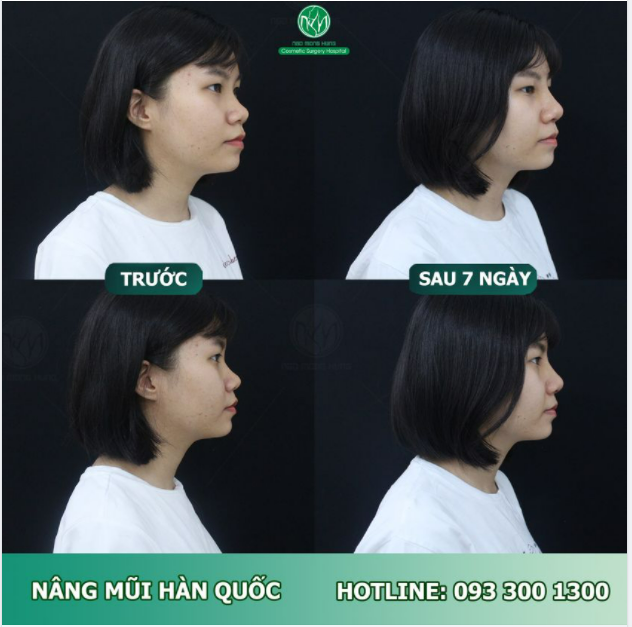 7 NGÀY THAY ĐỔI NHAN SẮC